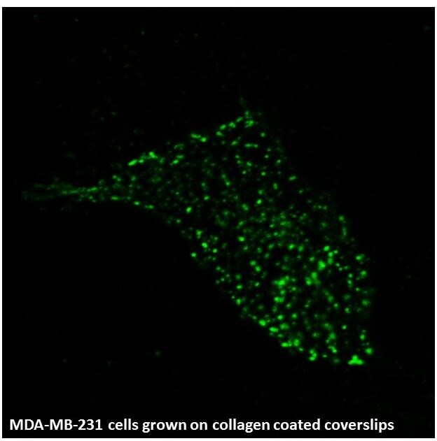 Human Integrin  beta 5 Antibody AF3824